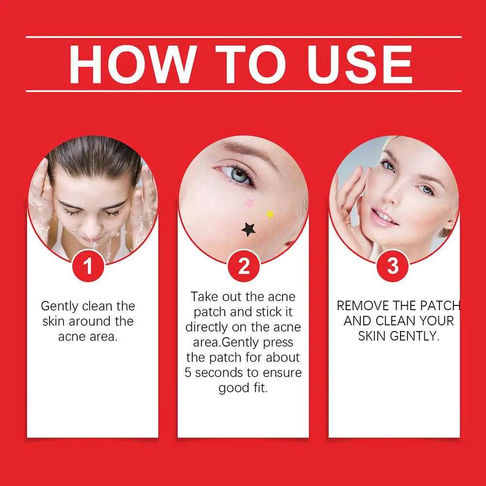 200Pcs Acne Pimple Patch Sticker Waterproof Acne Treatment Pimple Remover Tool Blemish Spot Facial Mask SkinCare Hidden Pimple Graceupnow.com
